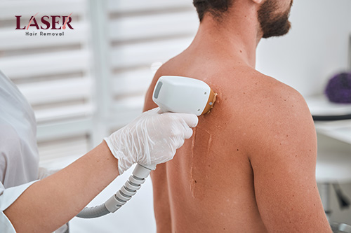 Back Side Laser Hair Removal for men